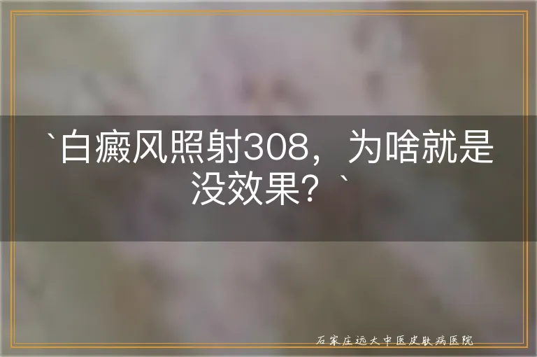 `白癜风照射308，为啥就是没效果？`