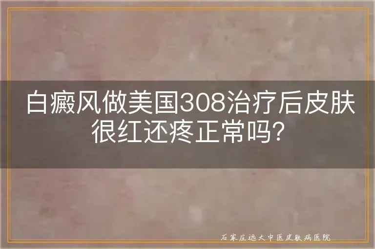 白癜风做美国308治疗后皮肤很红还疼正常吗？