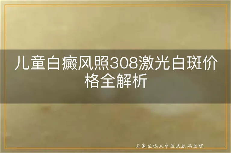 儿童白癜风照308激光白斑价格全解析