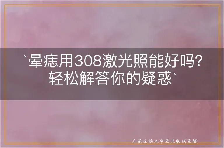 `晕痣用308激光照能好吗？轻松解答你的疑惑`