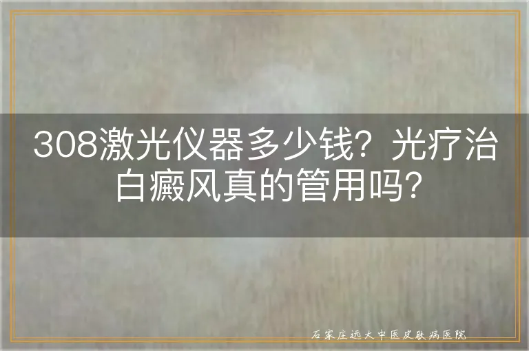 308激光仪器多少钱？光疗治白癜风真的管用吗？