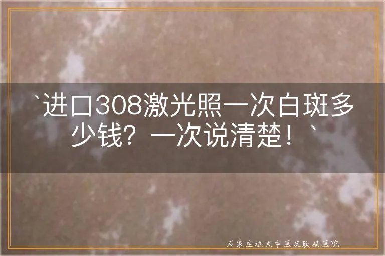 `进口308激光照一次白斑多少钱？一次说清楚！`