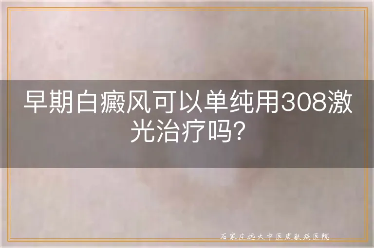 早期白癜风可以单纯用308激光治疗吗？