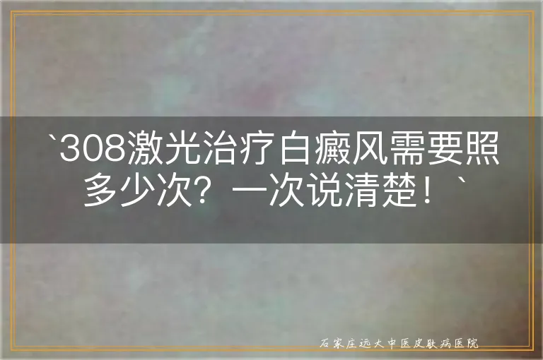 `308激光治疗白癜风需要照多少次？一次说清楚！`