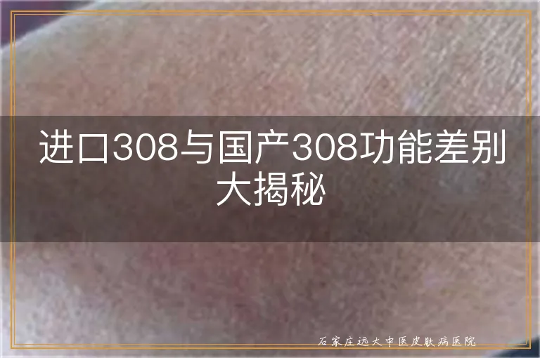 进口308与国产308功能差别大揭秘