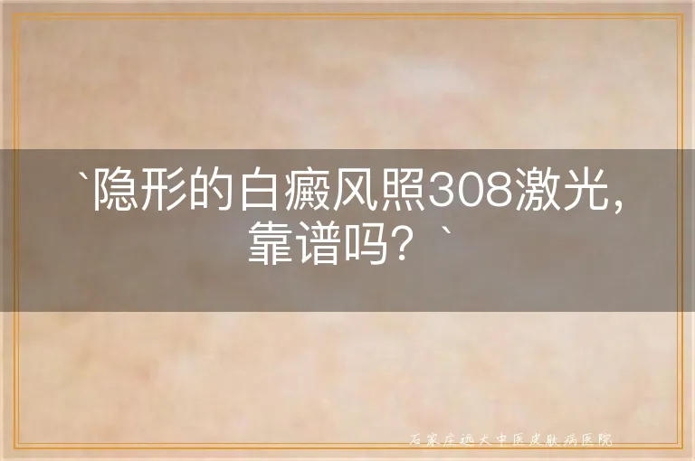 `隐形的白癜风照308激光，靠谱吗？`