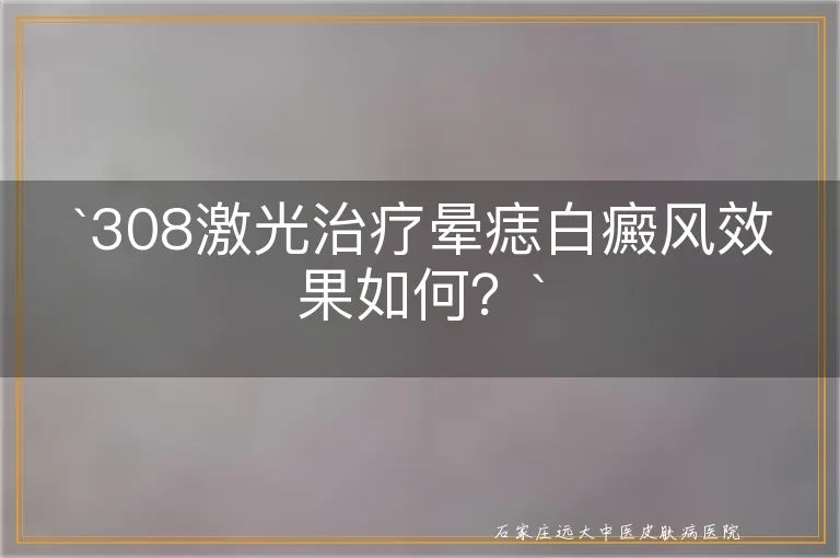 `308激光治疗晕痣白癜风效果如何？`