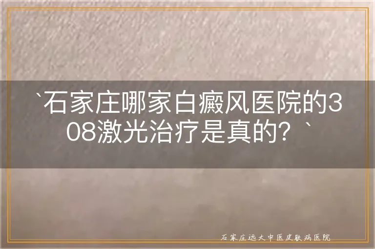 `石家庄哪家白癜风医院的308激光治疗是真的？`