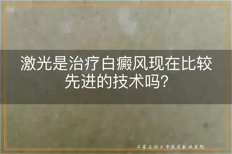 激光是治疗白癜风现在比较先进的技术吗？