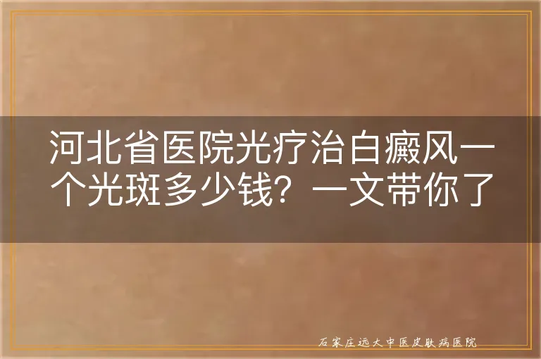 河北省医院光疗治白癜风一个光斑多少钱？一文带你了解清楚！