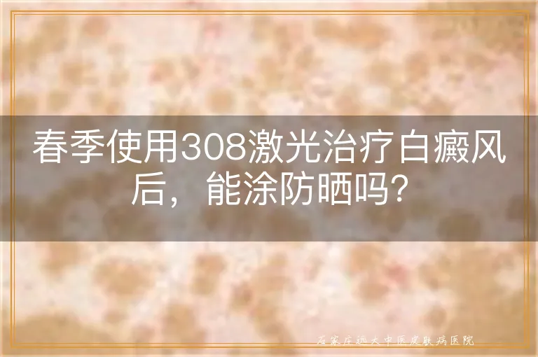 春季使用308激光治疗白癜风后，能涂防晒吗？