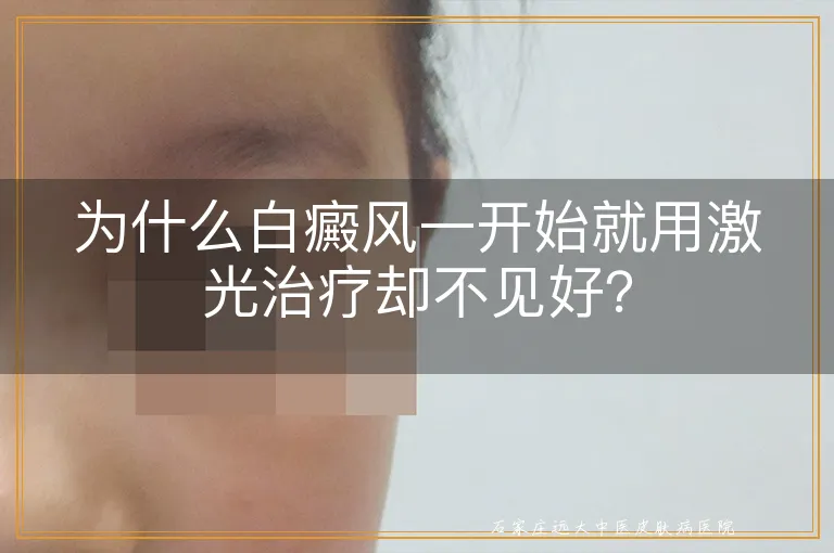 为什么白癜风一开始就用激光治疗却不见好？