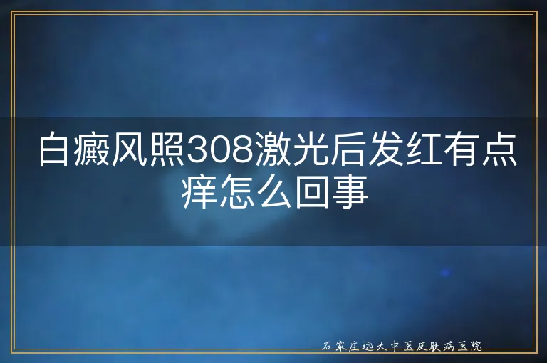 白癜风照308激光后发红有点痒怎么回事