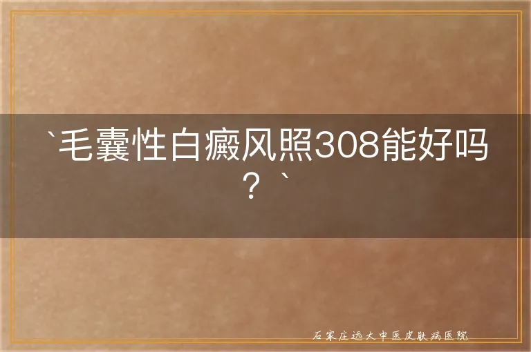 `毛囊性白癜风照308能好吗？`