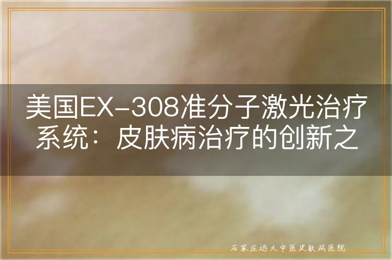 美国EX-308准分子激光治疗系统：皮肤病治疗的创新之光