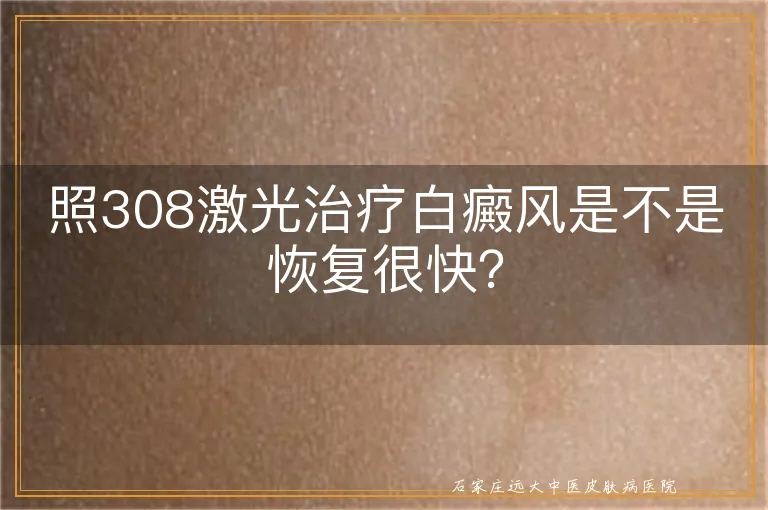 照308激光治疗白癜风是不是恢复很快？