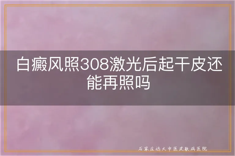 白癜风照308激光后起干皮还能再照吗