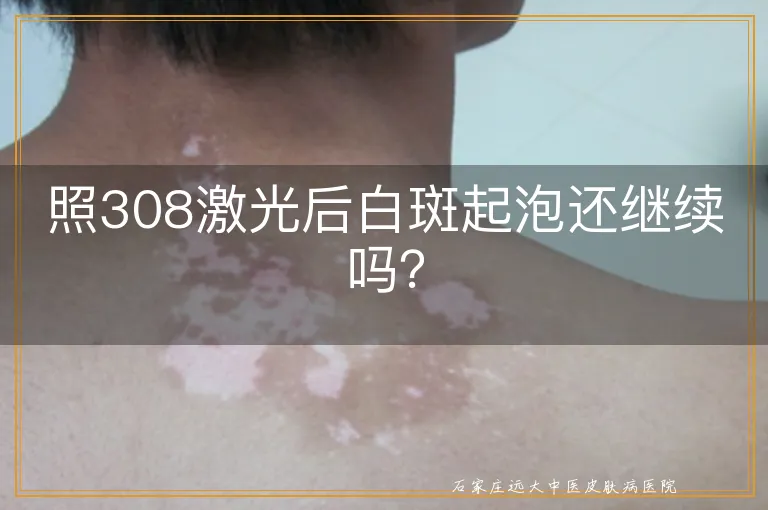 照308激光后白斑起泡还继续吗？