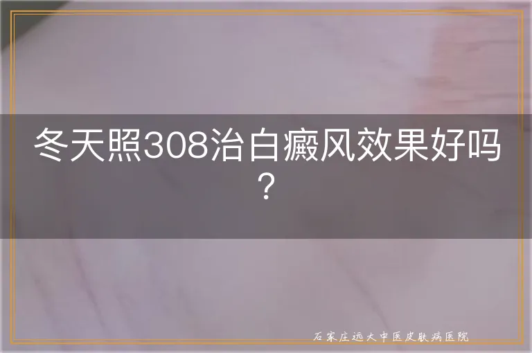 冬天照308治白癜风效果好吗？