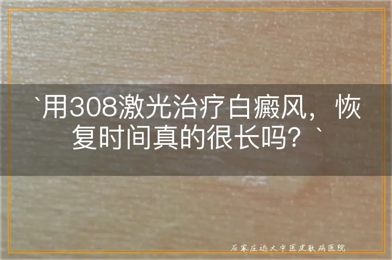 `用308激光治疗白癜风，恢复时间真的很长吗？`