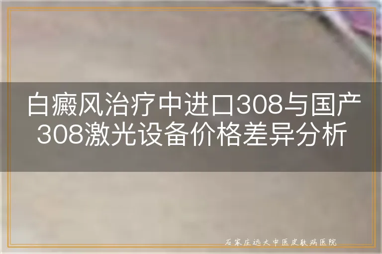 白癜风治疗中进口308与国产308激光设备价格差异分析