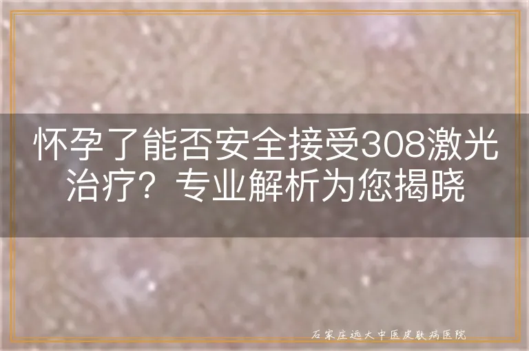 怀孕了能否安全接受308激光治疗？专业解析为您揭晓