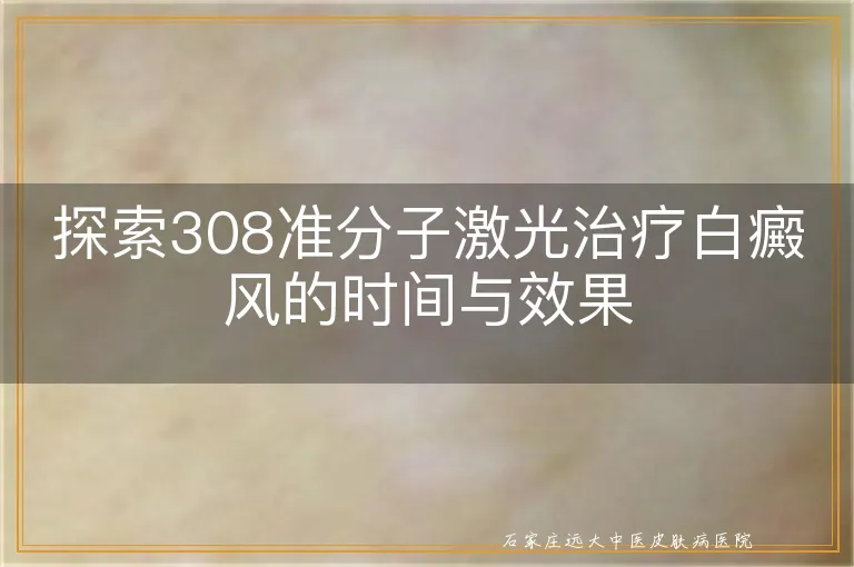 探索308准分子激光治疗白癜风的时间与效果