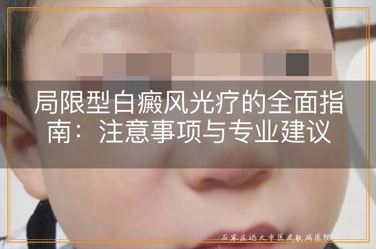 局限型白癜风光疗的全面指南：注意事项与专业建议