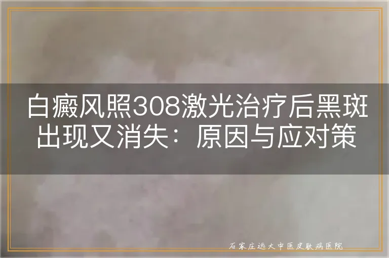 白癜风照308激光治疗后黑斑出现又消失：原因与应对策略