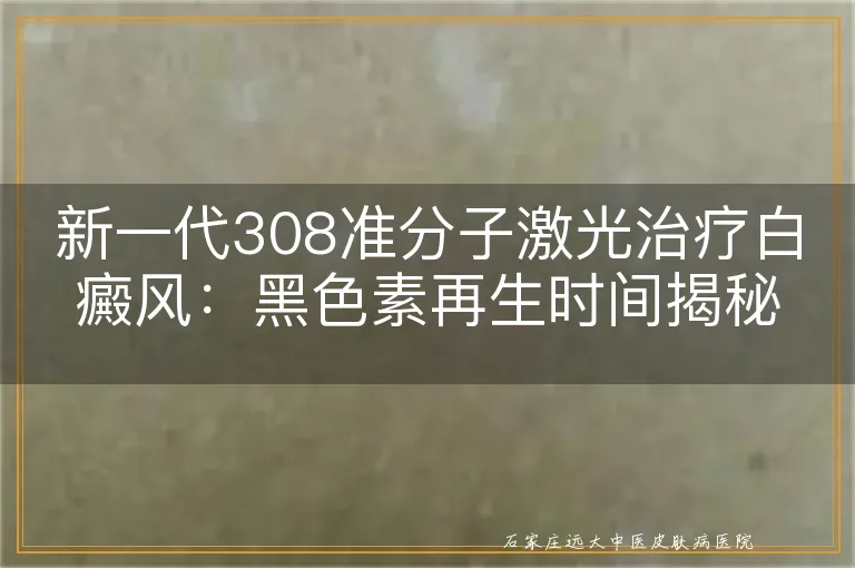 新一代308准分子激光治疗白癜风：黑色素再生时间揭秘