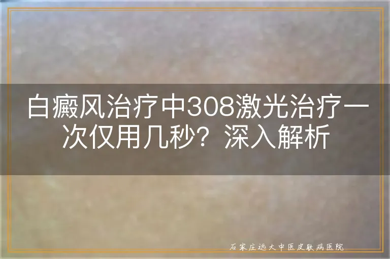 白癜风治疗中308激光治疗一次仅用几秒？深入解析