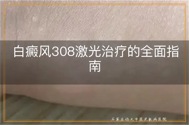 白癜风308激光治疗的全面指南