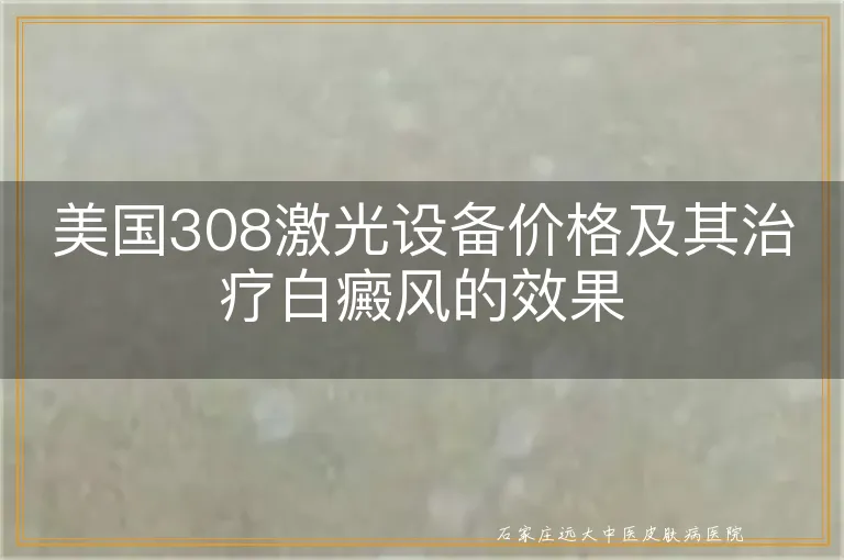 美国308激光设备价格及其治疗白癜风的效果