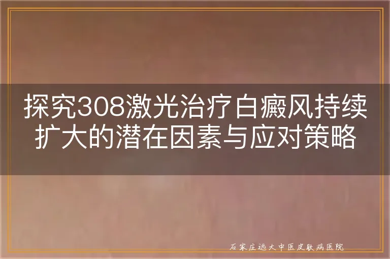 探究308激光治疗白癜风持续扩大的潜在因素与应对策略