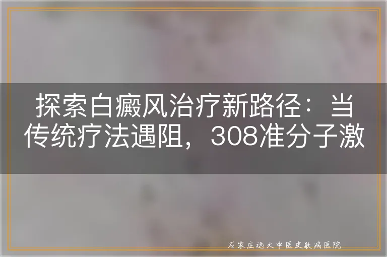 探索白癜风治疗新路径：当传统疗法遇阻，308准分子激光能否成为新希望？