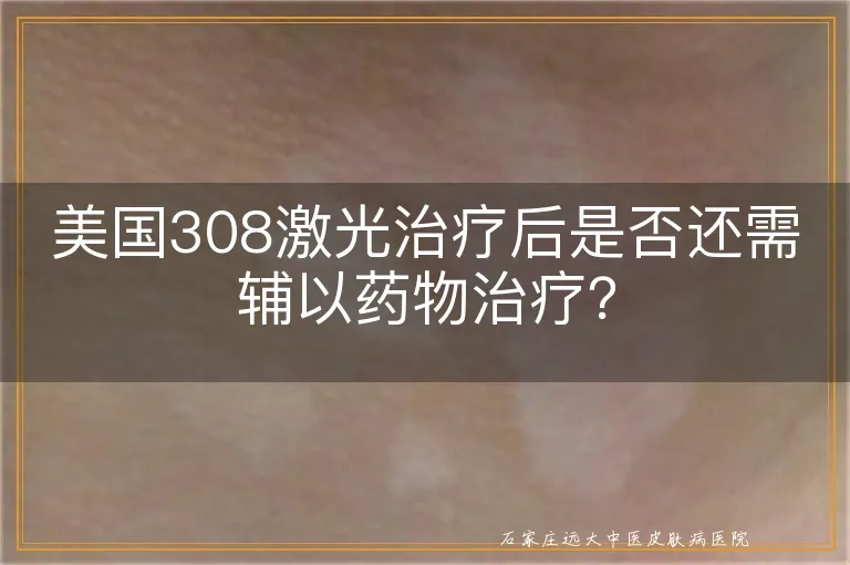 美国308激光治疗后是否还需辅以药物治疗？