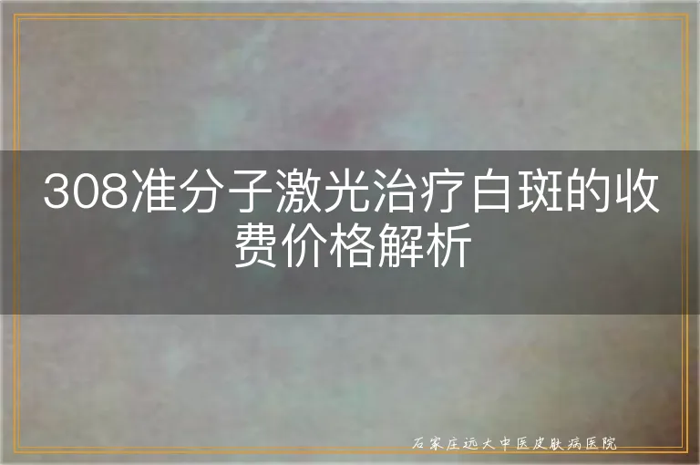 308准分子激光治疗白斑的收费价格解析