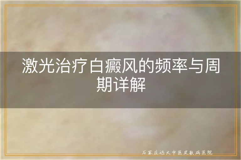 激光治疗白癜风的频率与周期详解