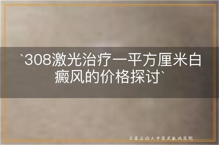 308激光治疗一平方厘米白癜风的价格探讨