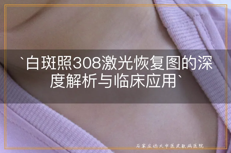 白斑照308激光恢复图的深度解析与临床应用