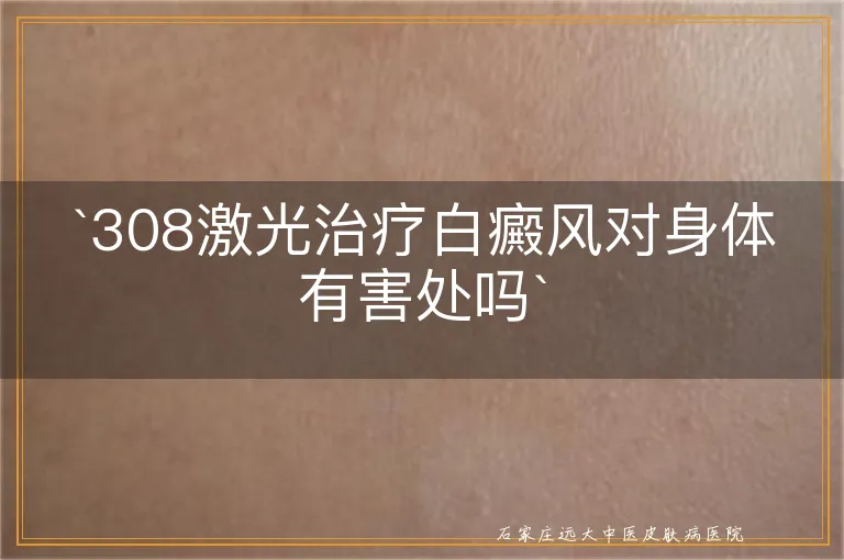 308激光治疗白癜风对身体有害处吗