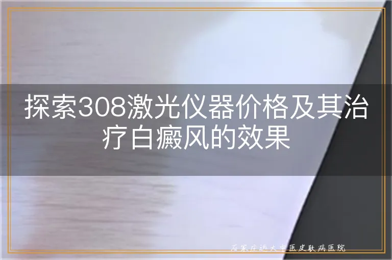 探索308激光仪器价格及其治疗白癜风的效果