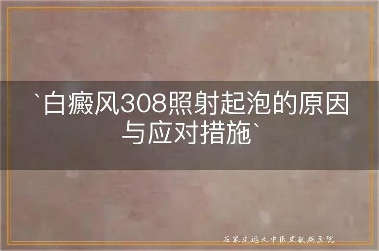 白癜风308照射起泡的原因与应对措施