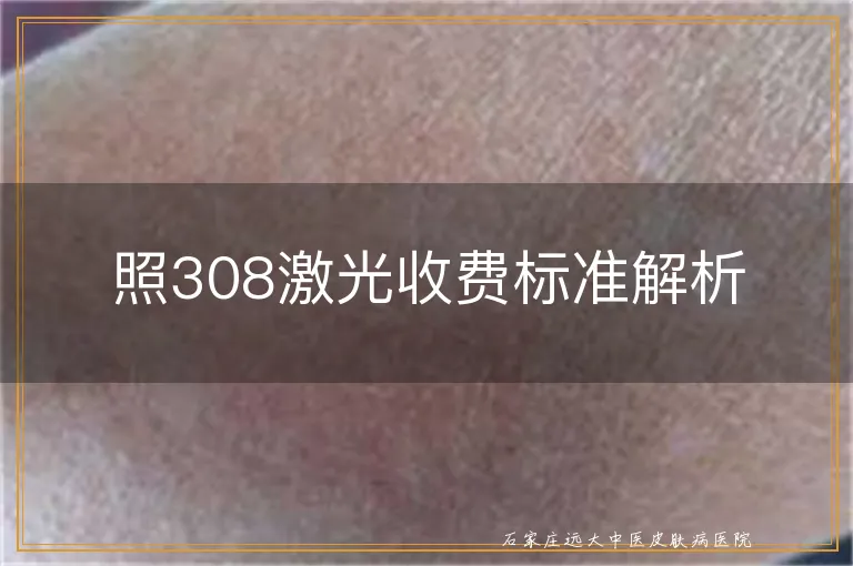 照308激光收费标准解析