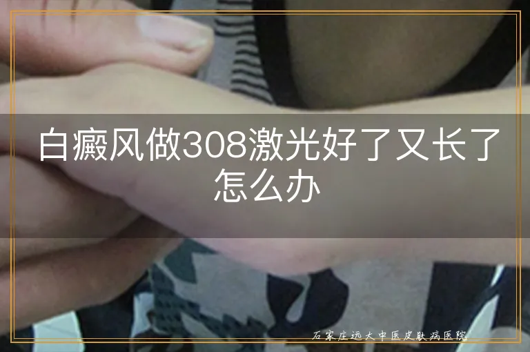 白癜风做308激光好了又长了怎么办