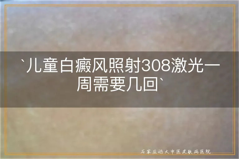 儿童白癜风照射308激光一周需要几回