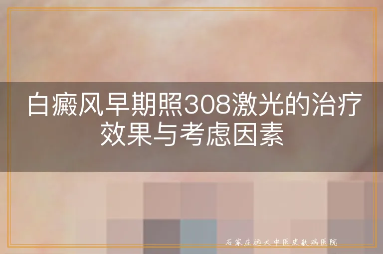 白癜风早期照308激光的治疗效果与考虑因素