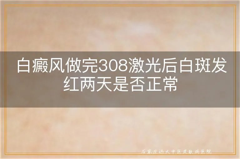 白癜风做完308激光后白斑发红两天是否正常