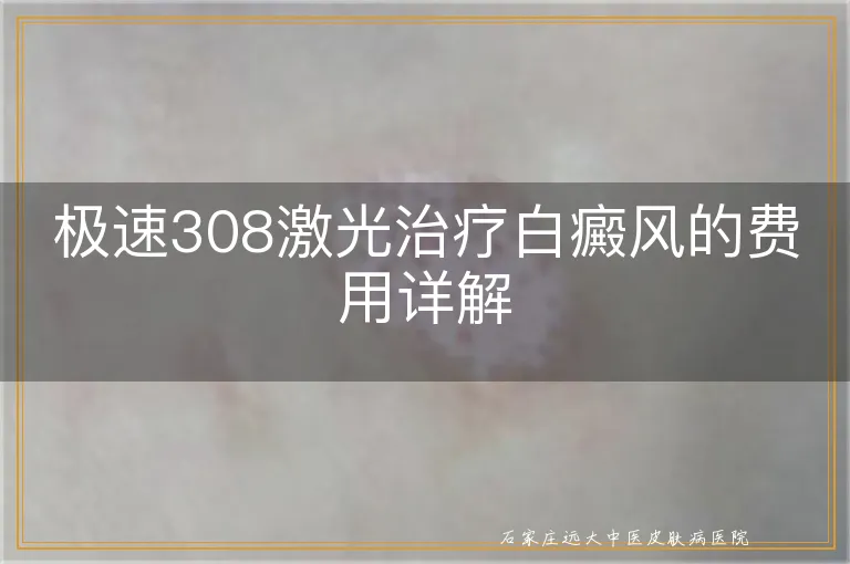 极速308激光治疗白癜风的费用详解