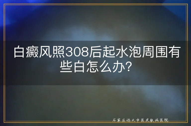 白癜风照308后起水泡周围有些白怎么办？